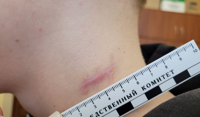 Мужчина чуть не убил двух парней из-за громкой музыки во дворе