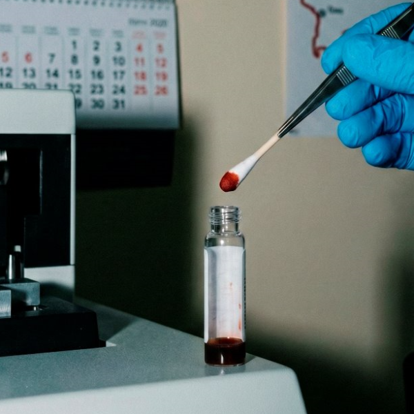 В Лунинецком районе по капле крови установлен злоумышленник, совершивший кражу в 2020 году