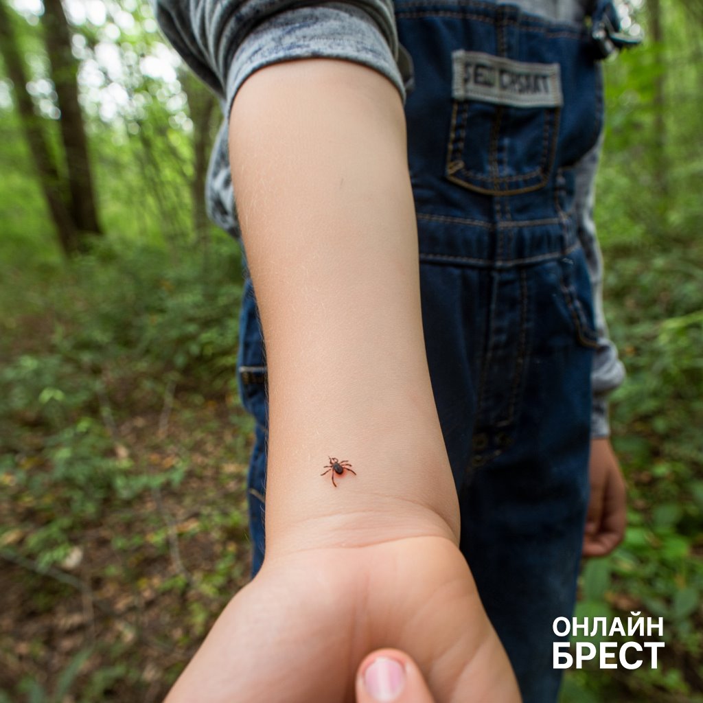 В Бресте резко выросла активность клещей: уже 194 пострадавших, половина — дети