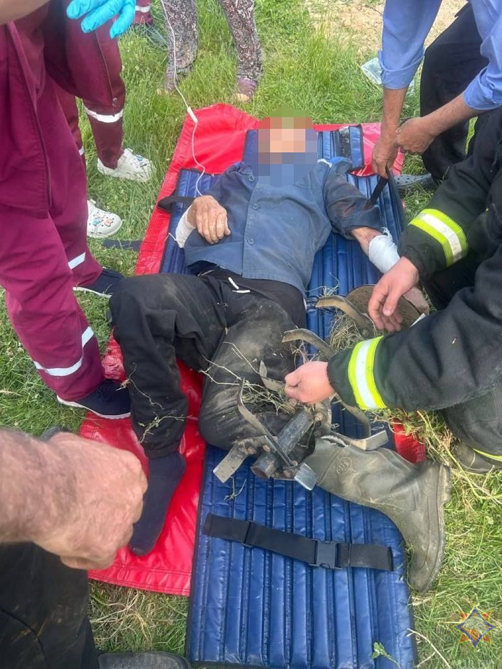 В Ивацевичском районе ногу мужчины зажало в мотокультиваторе