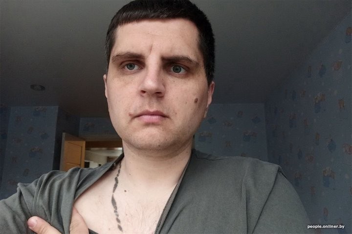 Кому цепочку под кожу, а кого упорно преследует. Истории белорусов, которые близко сталкивались с молнией