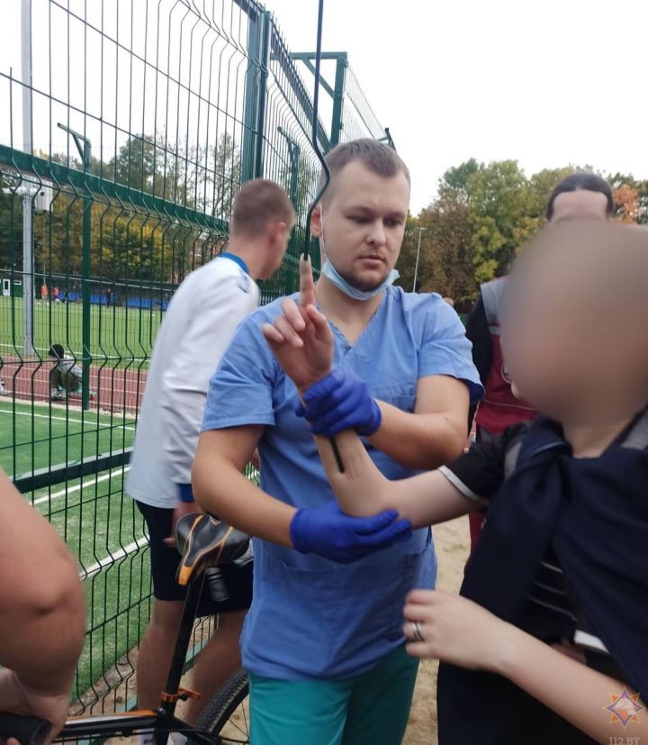 Прут вышел из указательного пальца. Подросток пробил руку и повис на заборе