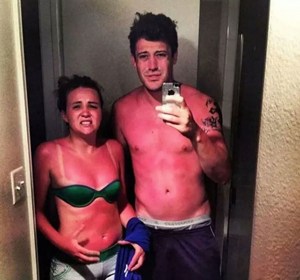 Эти фотографии показали, почему использовать солнцезащитный крем — хорошая идея!