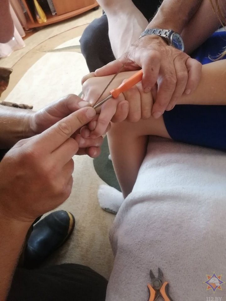 В Беларуси спасатели помогли ребенку снять кольцо с пальца