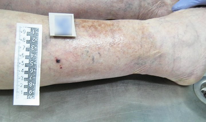 В Беларуси змея укусила на даче пенсионерку. Она умерла