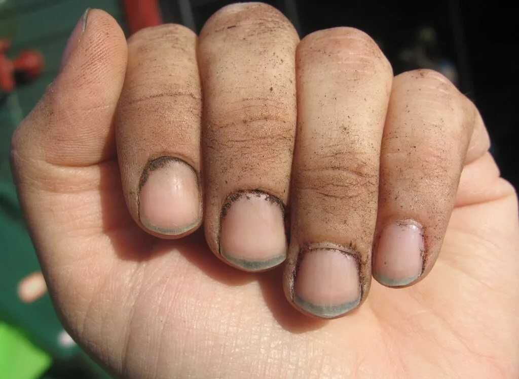 Какие болезни передаются через грязные руки?