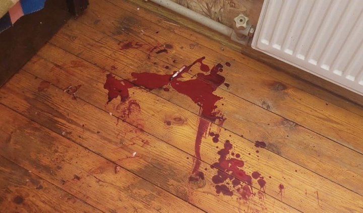 Белорус разбирал дома гранату и она взорвалась