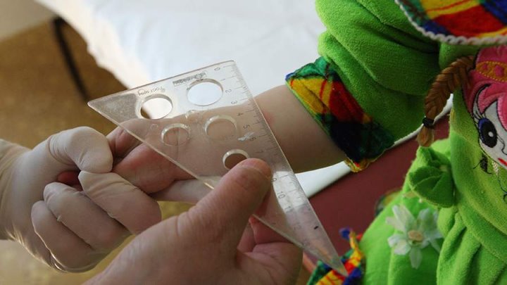 Можно ли мочить пробу Манту?