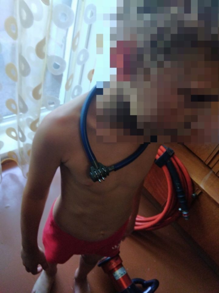 Семилетний мальчик в Рогачеве надел на голову стальной трос с кодовым замком и застрял. Опубликованы фото