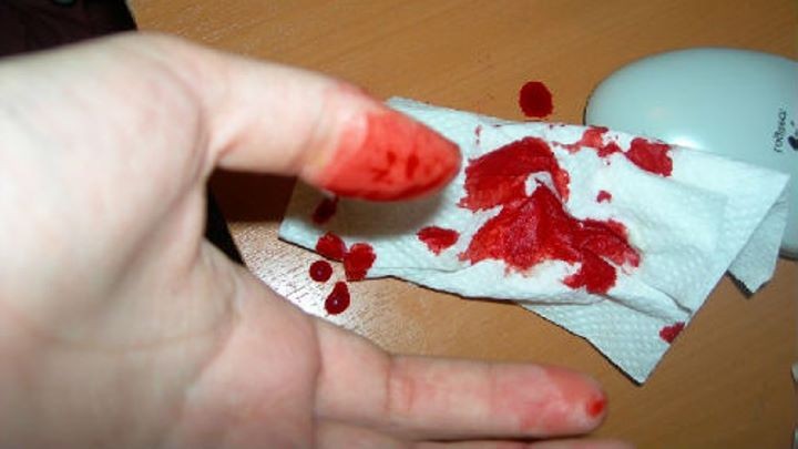 Житель Барановичей ударил родного брата ножом во время ссоры