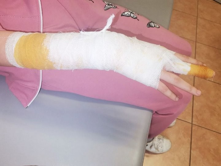 В Гомеле собака на глазах у хозяйки покусала 13-летнюю школьницу