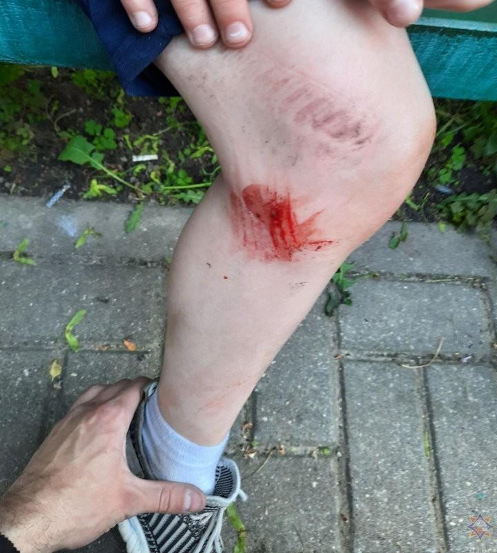 В Беларуси работники МЧС помогли мальчику, который застрял в приямке