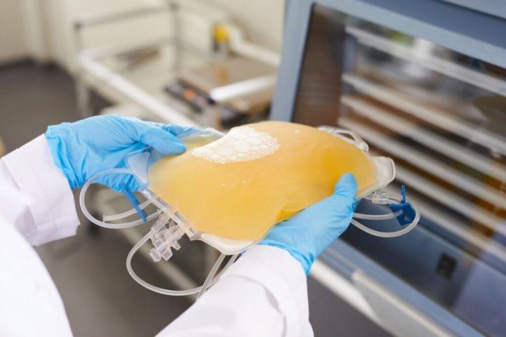 В Ганцевичах появится новый завод по производству препаратов из плазмы — первый подобный в СНГ