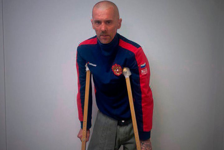 Белорус поехал на заработки в Россию, попал в рабство и лишился ноги