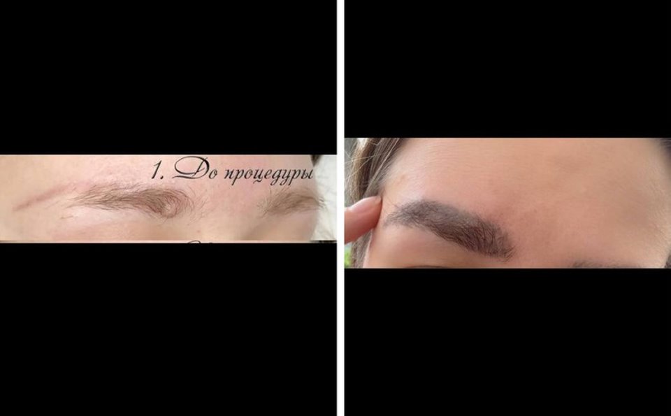 Белоруска сделала пересадку бровей. Ролик с последствиями собрал почти полмиллиона просмотров