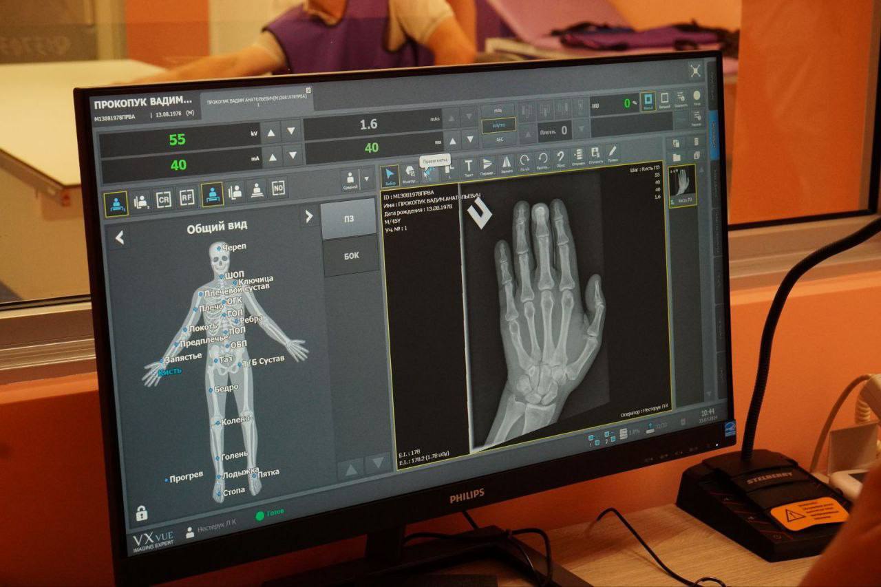 В Брестской городской поликлинике №6 улучшена доступность рентгенологических исследований