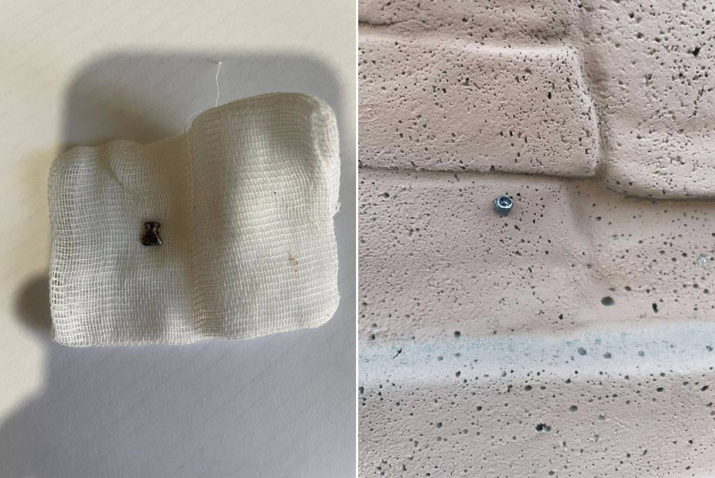 Белорус стрелял из пневматики по деревьям, а попал по 3-летней девочке — возбуждено дело