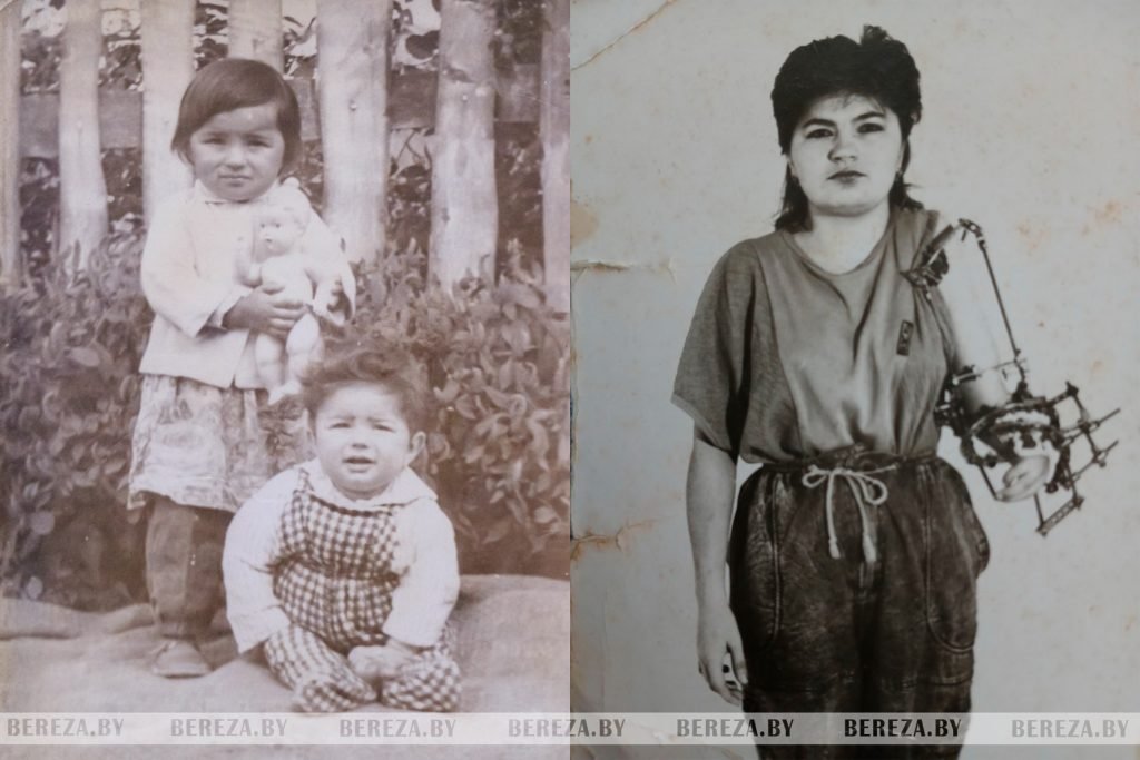 История березовчанки, которая родилась без части