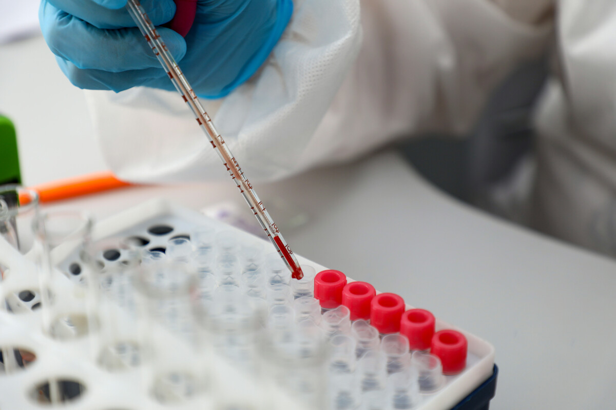 На Брестчине в первом квартале зарегистрировано 87 случаев сальмонеллезной инфекции среди населения