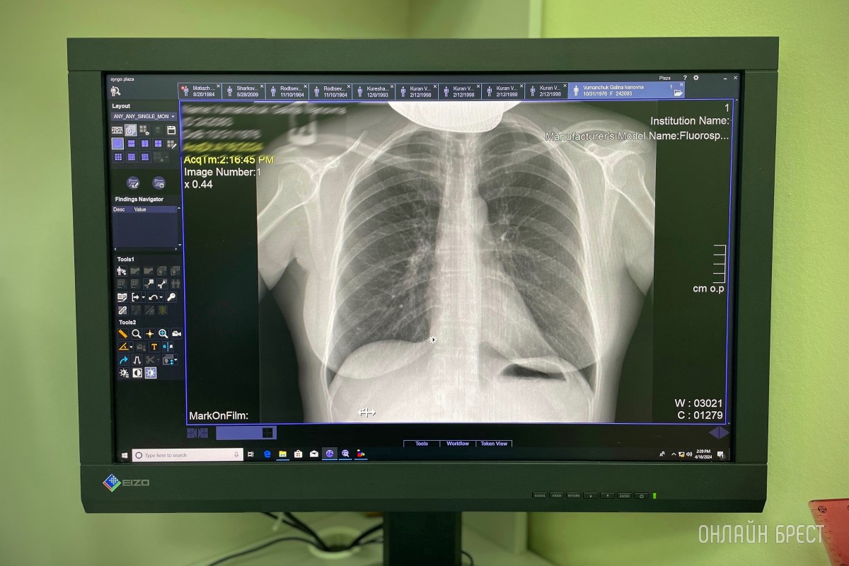 Брест – снижение стоимости на рентген и МРТ!