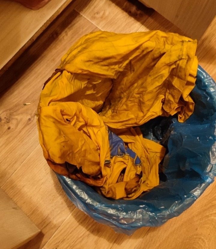 В Гомеле во время готовки на газовой плите на ребенке загорелась одежда