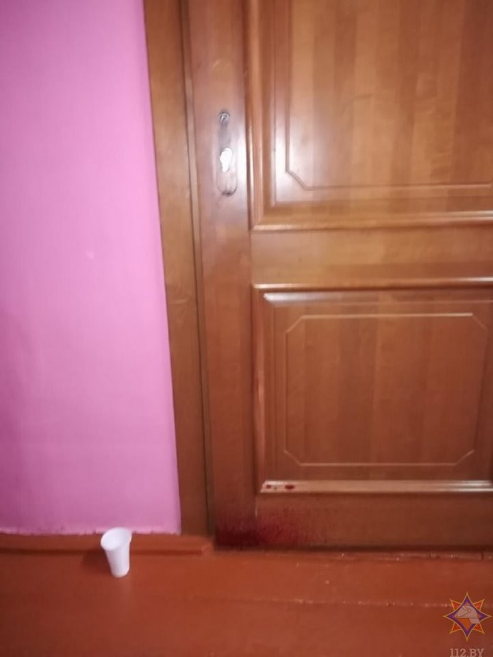 В Березе школьник пробил предплечье дверной ручкой