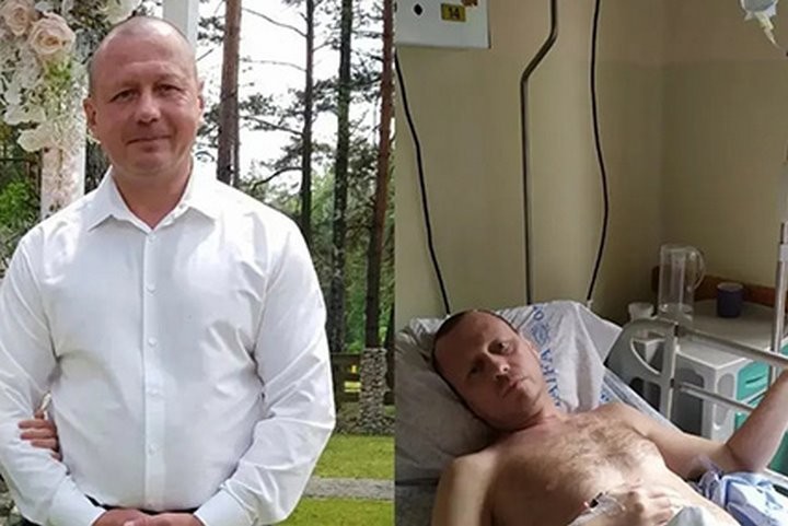 Всё началось после перенесённого ковида. Жителю Дрогичина Дмитрию Хмилевскому требуется срочная помощь