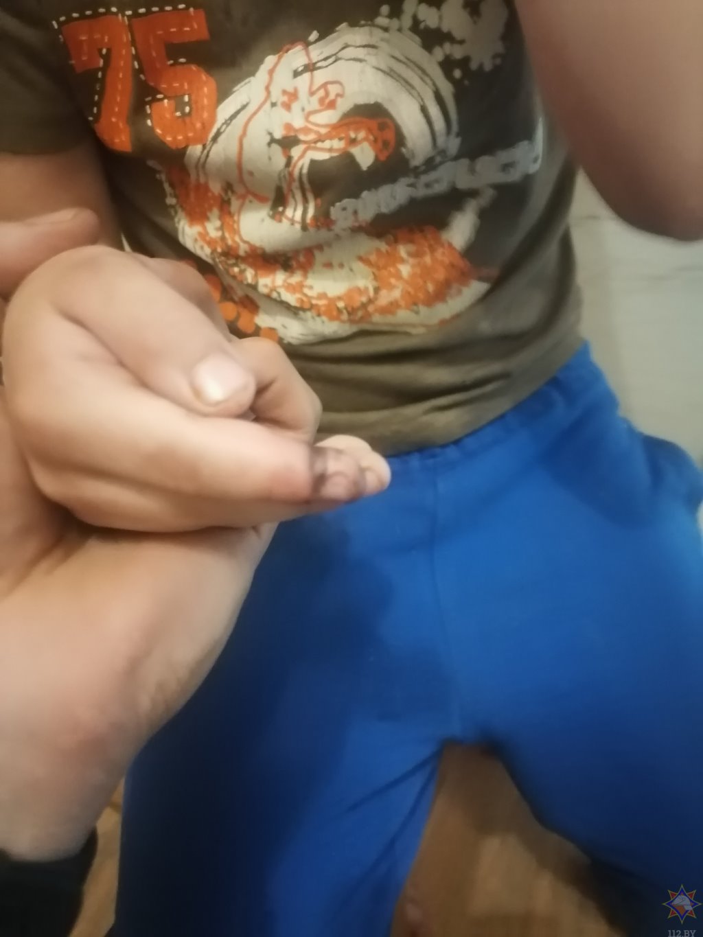 Спасатели помогли мальчику освободить палец из велосипедной цепи