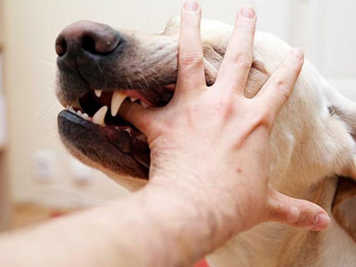 В Гомеле девочка пострадала от укусов собаки, но родители не вызвали врача