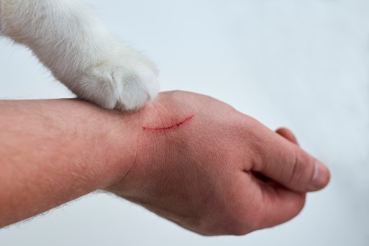 Болезнь кошачьих царапин: чем вас может заразить пушистый любимец