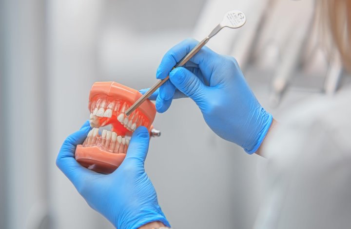 Лечить зубы станет немного дешевле? С 1 ноября вводится регулирование тарифов на все виды стоматологических услуг