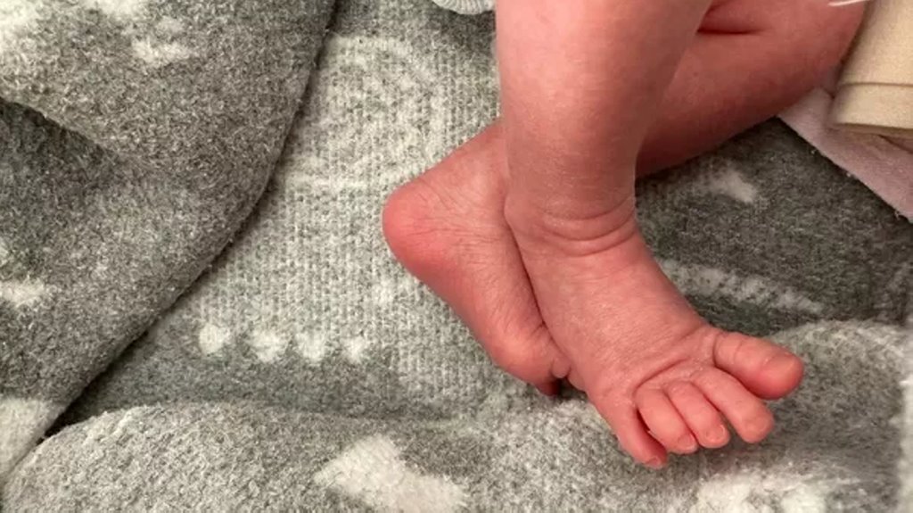 Один случай на 200 миллионов беременностей: гомельчанка родила трех близняшек