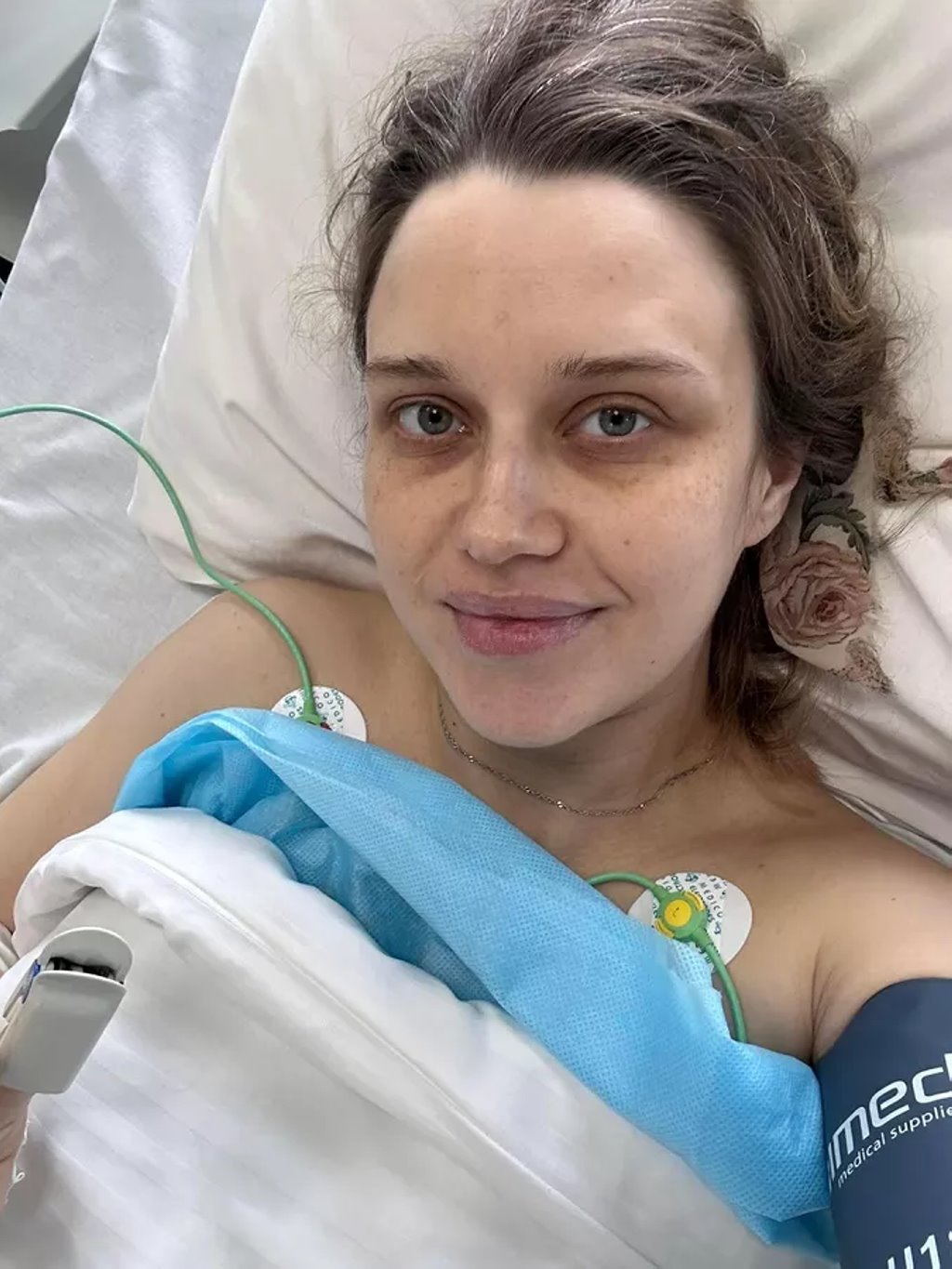 Один случай на 200 миллионов беременностей: гомельчанка родила трех близняшек