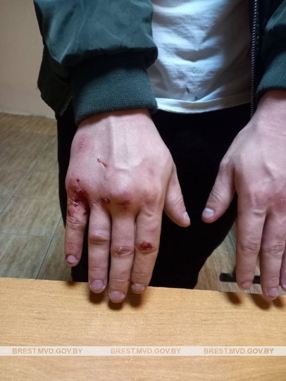 Молодой житель Бреста «подрался» с рекламным щитом. Что стало причиной?