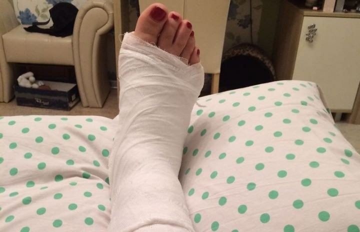 В Бресте за сутки число пострадавших от гололёда выросло до 30 человек