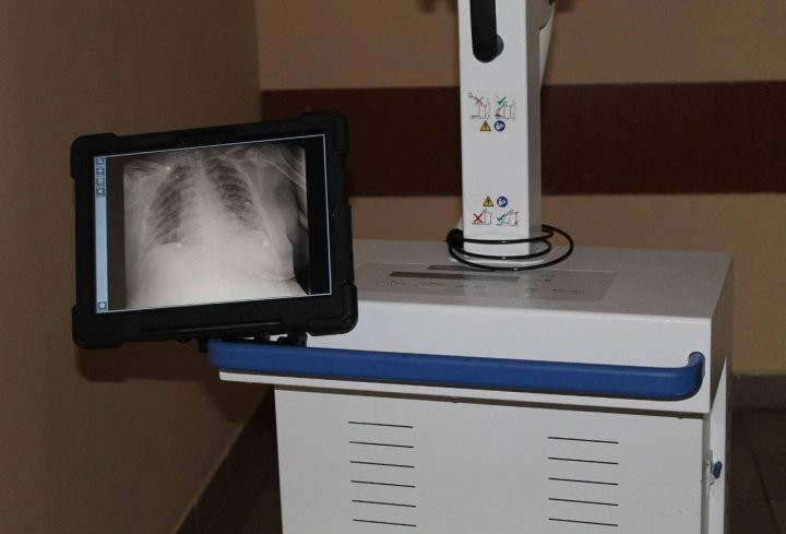 Новые рентген-аппараты поставили в Брестскую центральную городскую больницу