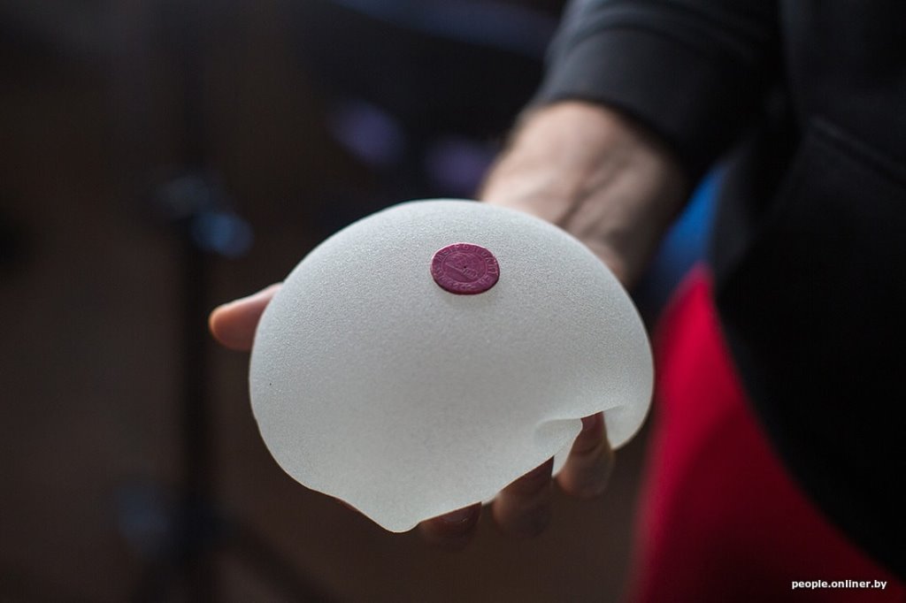 Новая грудь жене и любовнице председателя. Вот на что пошли деньги товариществ собственников