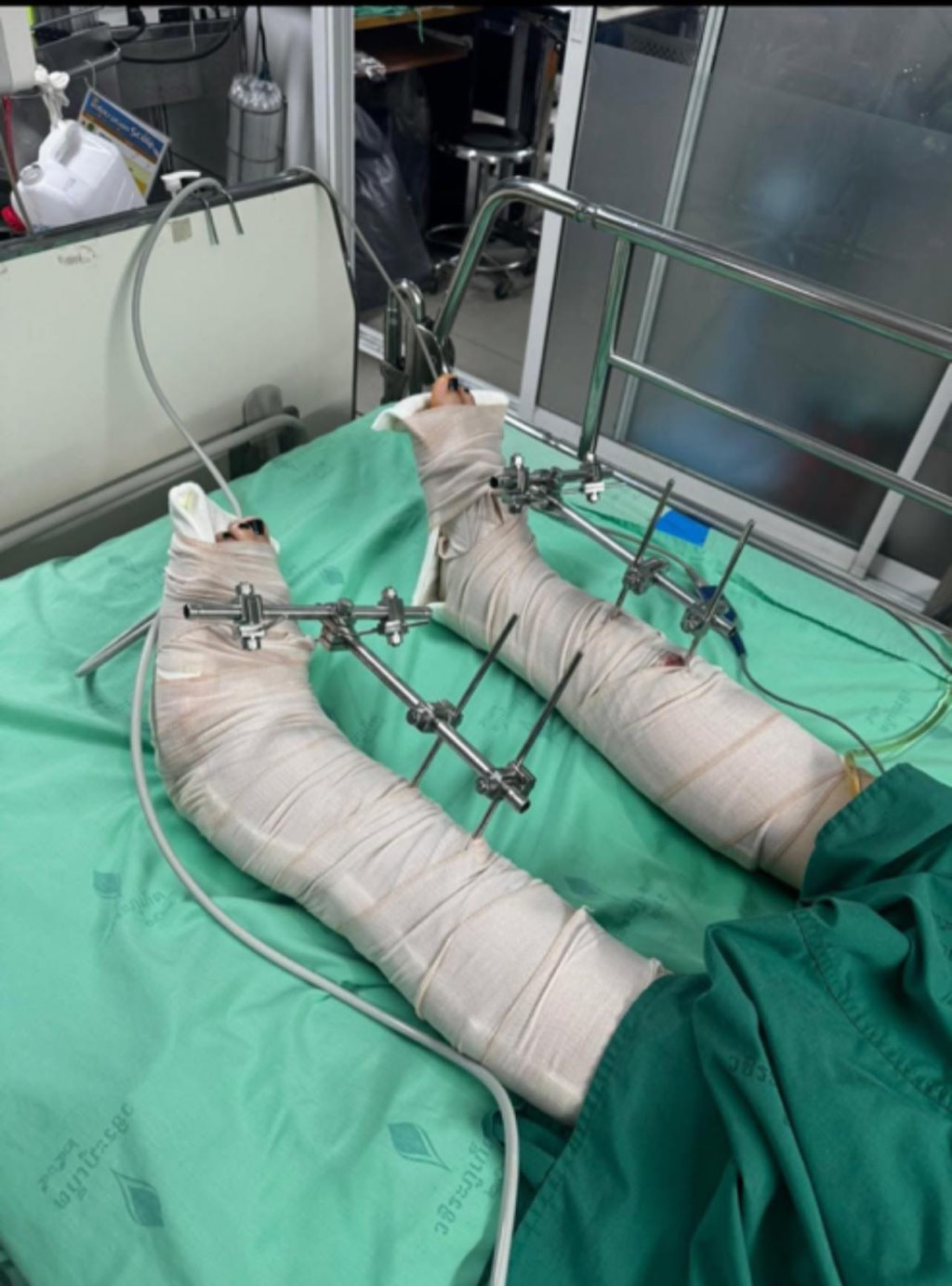 Белоруска упала с четвертого этажа отеля в Таиланде и получила тяжелые травмы — девушку транспортировали в Беларусь