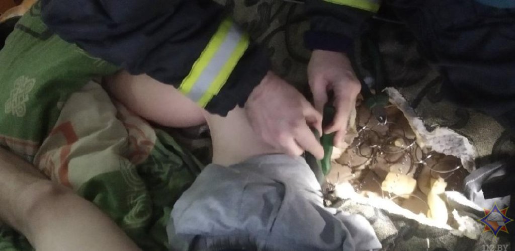 Пружина матраса проткнула ногу парня в Беларуси