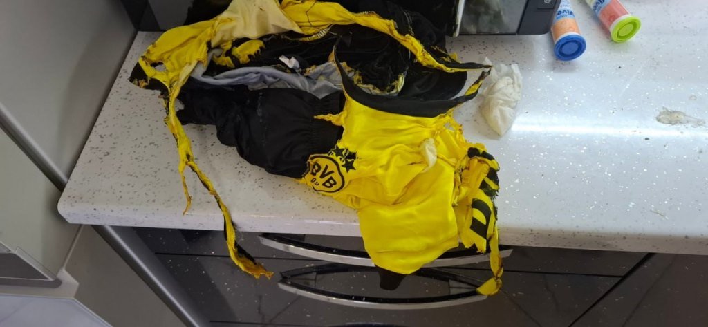 В Барановичах 9-летний мальчик получил ожоги из-за загоревшейся на нем одежды