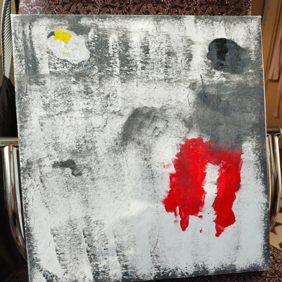 Женщина из Брестской области в 32 года потеряла зрение