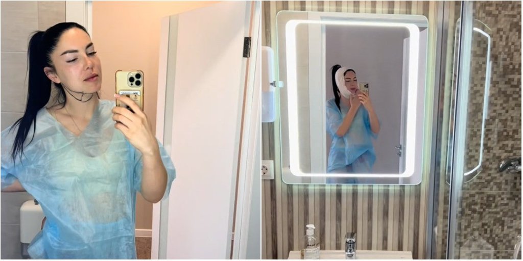 Белоруска сделала липосакцию подбородка. Сколько это стоило?