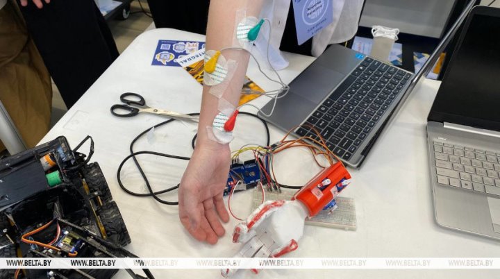 Школьница из Бреста разработала механический протез руки