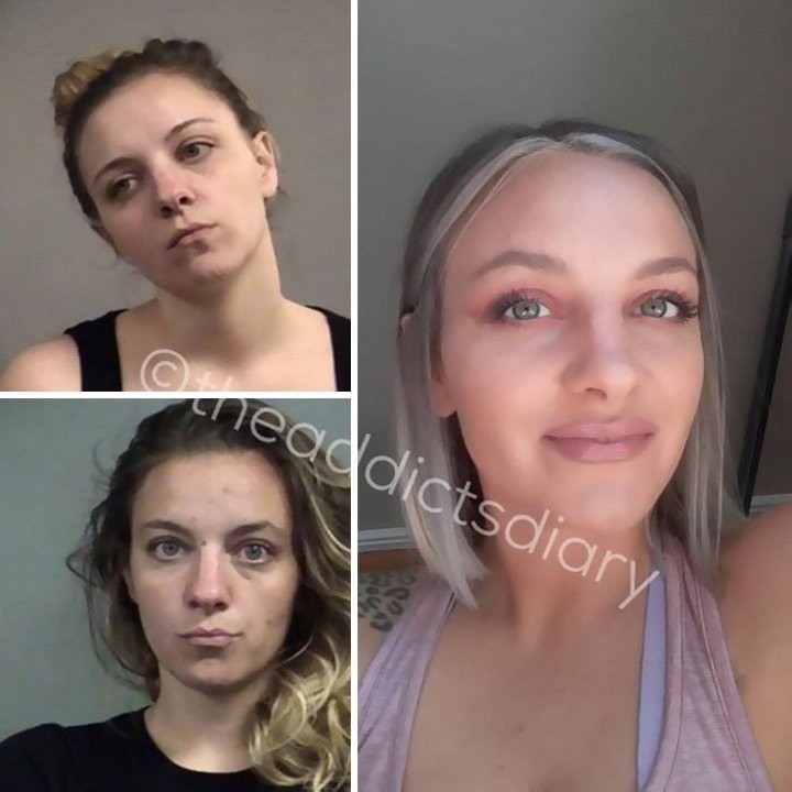 Посмотрите, как изменились завязавшие наркоманы и алкоголики