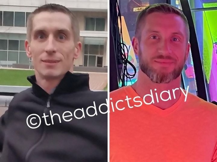 Посмотрите, как изменились завязавшие наркоманы и алкоголики