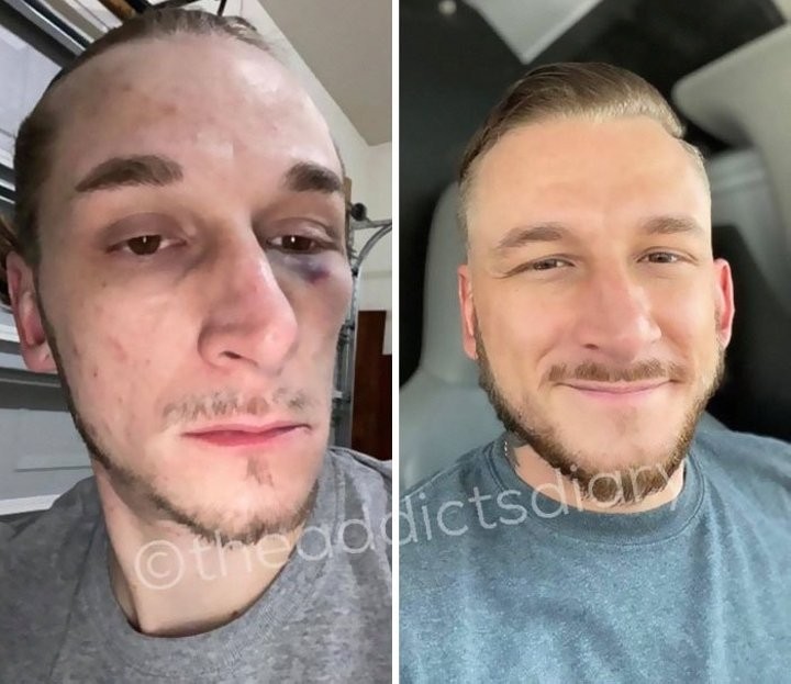 Посмотрите, как изменились завязавшие наркоманы и алкоголики