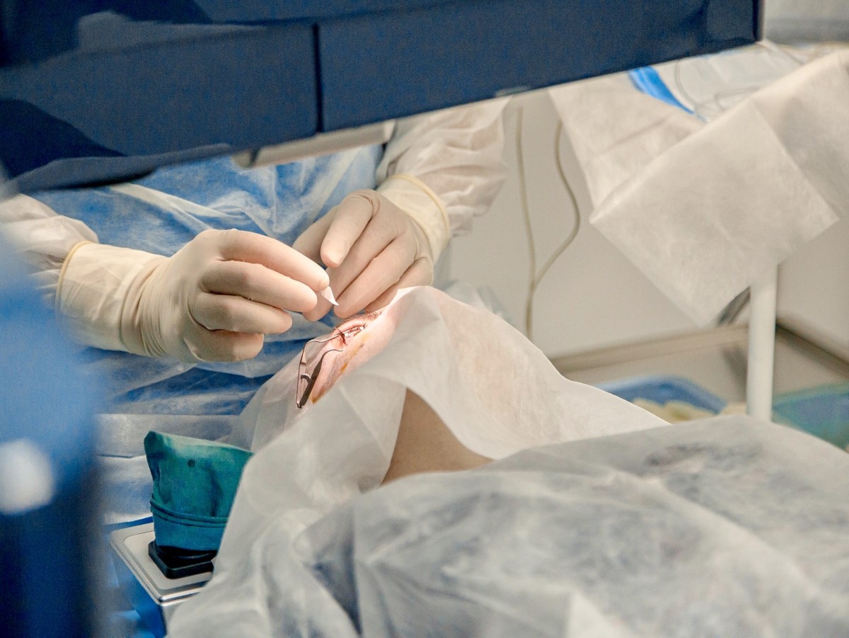 Избавьтесь от очков и контактных линз. Лазерная коррекция зрения в Бресте всего за 10 минут изменит вашу жизнь навсегда