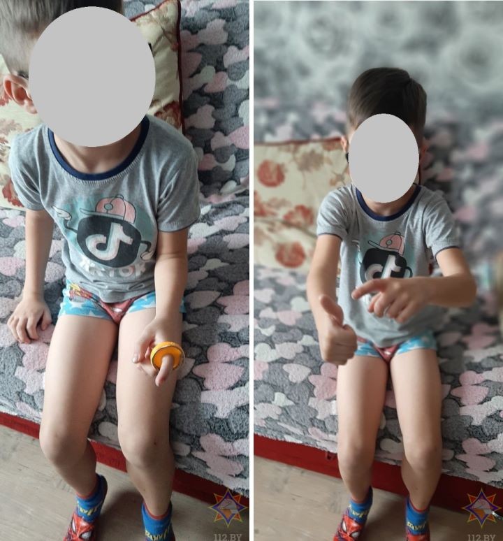 Cпасатели помогли мальчику, у которого палец застрял в пластиковой игрушке. Случай в Брестской области
