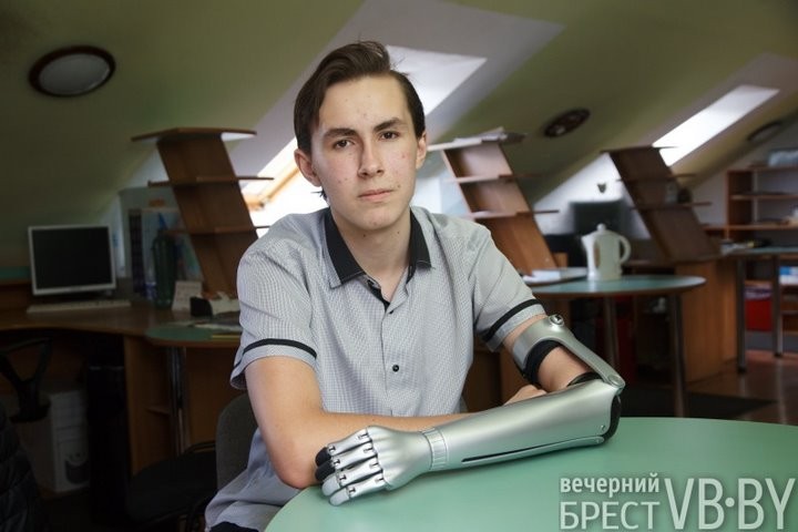 Дорогостоящий протез изменил жизнь брестского подростка