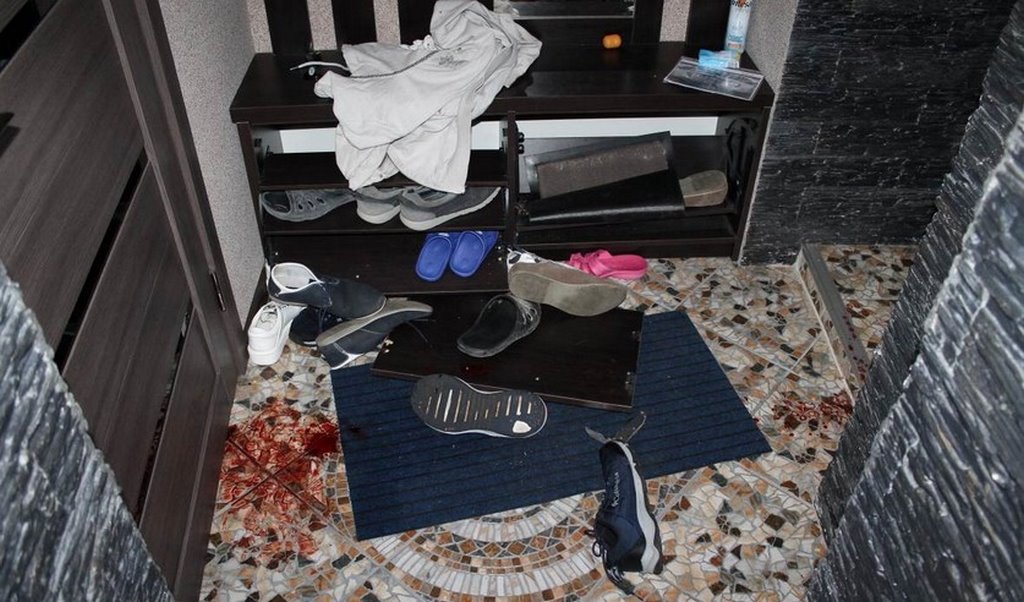 Была недовольна его образом жизни. В Беларуси сын ударил мать ножом в голову — она в реанимации